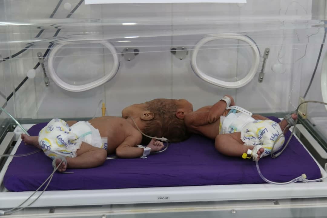 الوصول الانساني قصة نجاح من سيئون - صندوق الامم المتحدة للسكان ومركز الملك سلمان