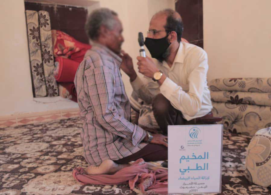 ازالة المياه البيضاء اليمن